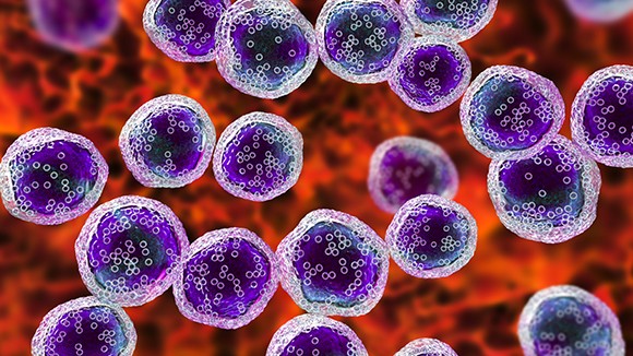 Leukemias and lymphomas Cancer Treatment in Hyderabad