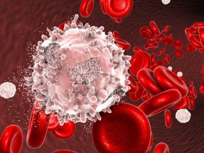 blood cancer Blood Cancer Service