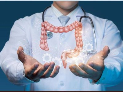 colon cancer Colon Cancer Service